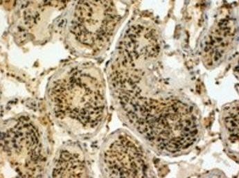 Goat anti-EDD1 / HYD Antibody