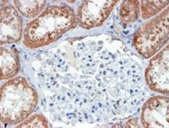 USP16/UBP-M Antibody