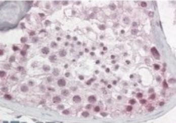 Goat anti-Pescadillo Antibody
