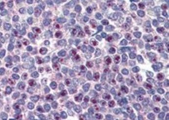 Goat anti-FOXC1 (C Term) Antibody
