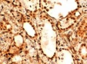 Goat anti-FOXE1 / TTF2 Antibody