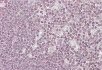 Goat anti-NIPP1 / PPP1R8 Antibody