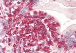 Goat anti-Coronin 1 / TACO Antibody
