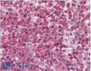 Goat anti-Coronin 1 / TACO Antibody