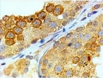 BOULE/BOLL Antibody