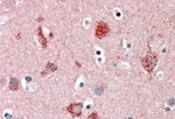 Goat anti-MUNC18 / STXBP1 (isoform a) Antibody