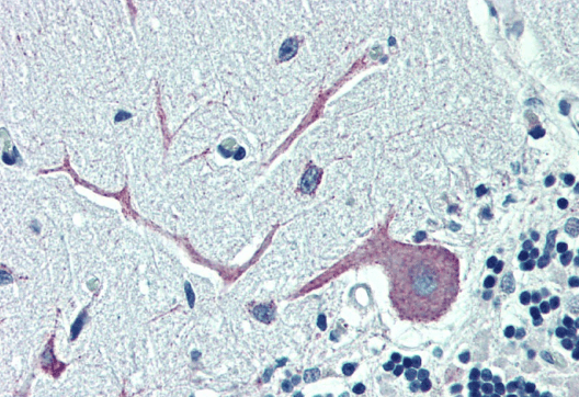 Goat anti-ORP1 Antibody