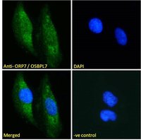 ORP7/OSBPL7 Antibody