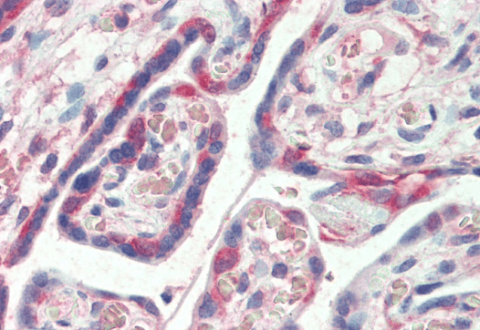 Goat anti-CLIM1 / PDLIM1 Antibody