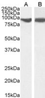 Goat anti-VPS35 / MEM3 Antibody