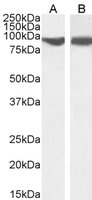 VPS35 antibody