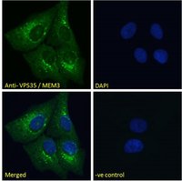 Goat anti-VPS35 / MEM3 Antibody