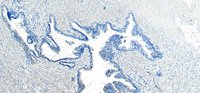 Goat anti-VPS35 / MEM3 Antibody