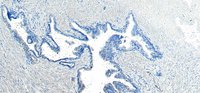 VPS35 antibody