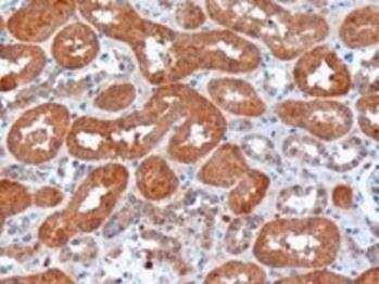 Goat anti-USH1C / Harmonin Antibody