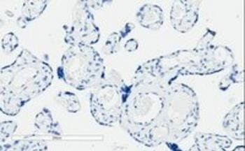Goat anti-PIK3C2A Antibody