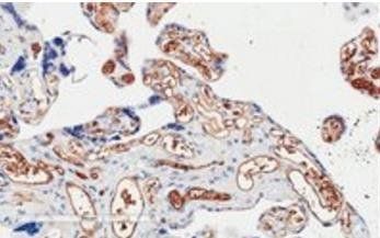 Goat anti-PIK3C2A Antibody