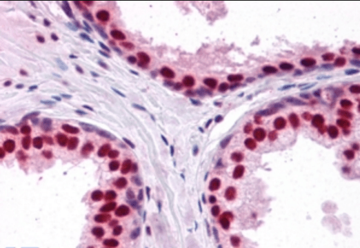 Goat anti-DDX5 / p68 RNA helicase Antibody