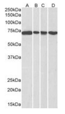 Goat anti-DDX5 / p68 RNA helicase Antibody