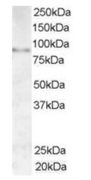 AKAP3/SOB1 Antibody