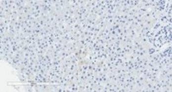 Goat anti-FENS1 / WDFY1 Antibody