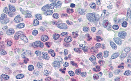 Goat anti-Munc13-4 / UNC13D (C terminus) Antibody