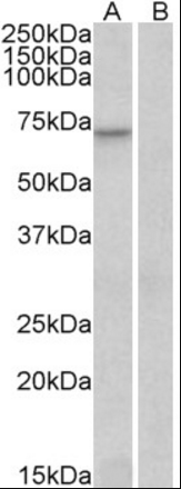Goat anti-FOXO3A / FOXO3 / FKHRL1 Antibody