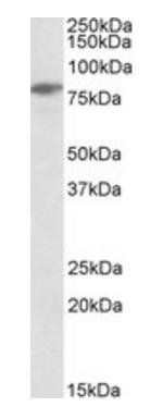 SLP76/LCP2 Antibody
