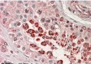 Goat anti-XAGE1 (Isoform 1d) / GAGED2 Antibody