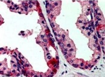 Goat anti-JIK / TAOK3 Antibody