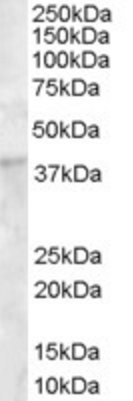 Goat anti-DKK1 Antibody