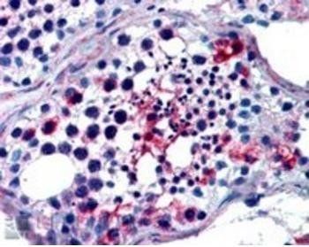 Goat anti-Fhl1/ Slim1 (mouse) Antibody