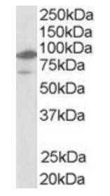 Goat anti-LXR beta / NR1H2 Antibody