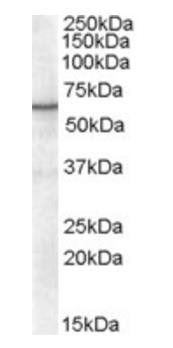 RXR alpha Antibody