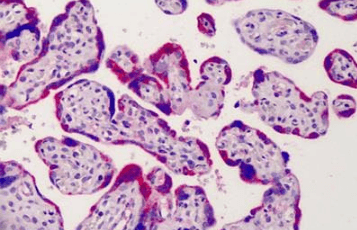 Goat anti-ADAM12 Antibody