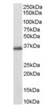 Goat anti-AKR1C3 Antibody