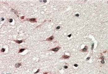 DYX1C1 (Isoform a) Antibody