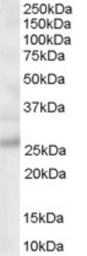 PCSK9 (C Terminus) Antibody