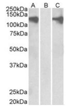 PUM2 Antibody