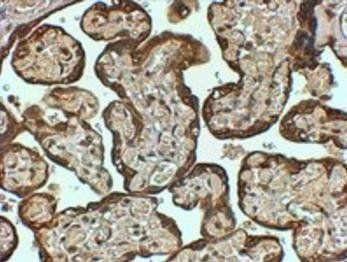 Goat anti-PAI1 / SERPINE1 Antibody