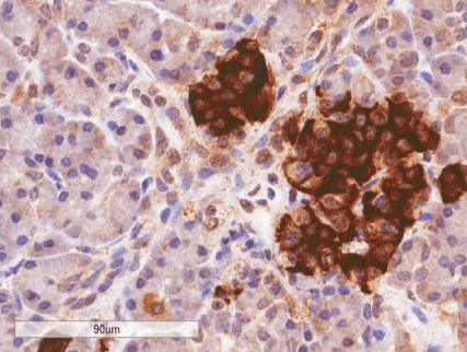 Goat anti-CCKAR Antibody