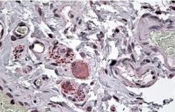 Goat anti-Neuropeptide Y receptor Y5 Antibody