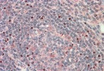 Goat anti-CTDSP1 Antibody