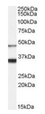 Orexin receptor 1 Antibody