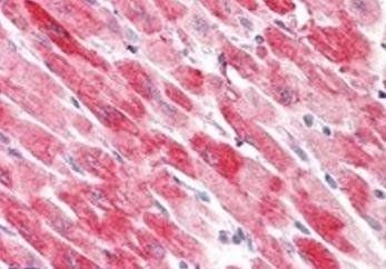 Goat anti-Cofilin 2 (muscle) Antibody
