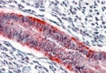 Goat anti-MMP7 Antibody