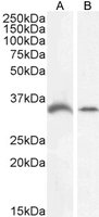 GDF15 antibody