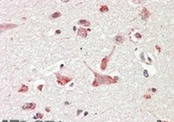 Goat anti-GOLGA6 / GLP Antibody