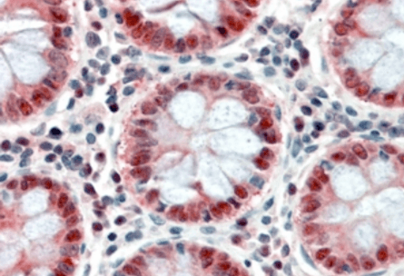 Goat anti-PTCH (C Terminus) Antibody