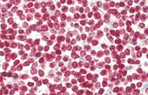 Foxp3 Antibody